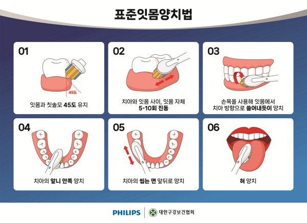 ▲ 표준잇몸양치법 안내 이미지